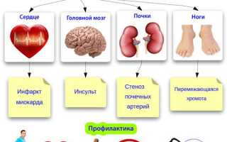 Стенозирующий атеросклероз