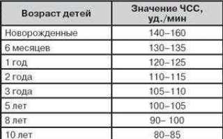 Желудочковый ритм на экг