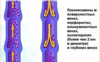 Клапанная недостаточность